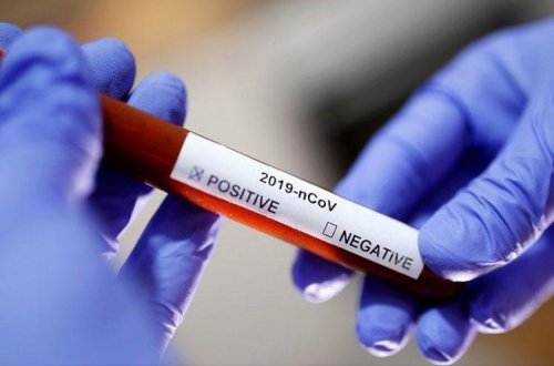 Moldovada indiyə kimi 72 nəfər koronavirusdan ölüb