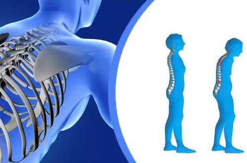 Ortoped-travmatoloq: osteoporoz əksər hallarda 50 yaşdan sonra başlayır